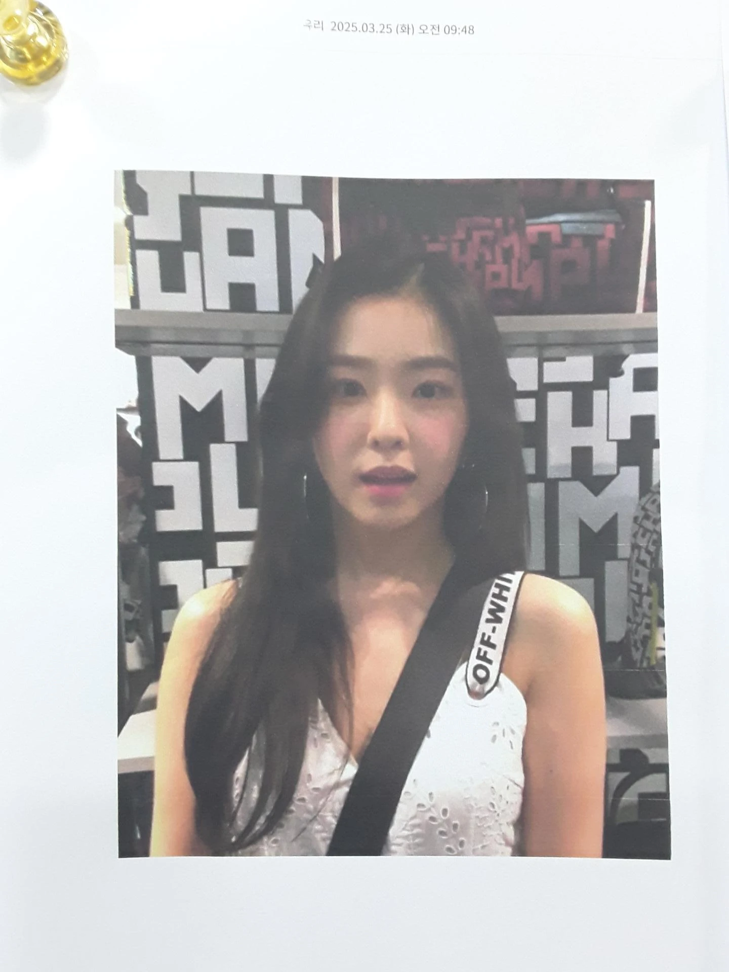 필러와 실 시술 뒤 코가 뭉툭해지는 이유, 이물질 제거와 코끝 교정 방법 — 본문 사진 10
