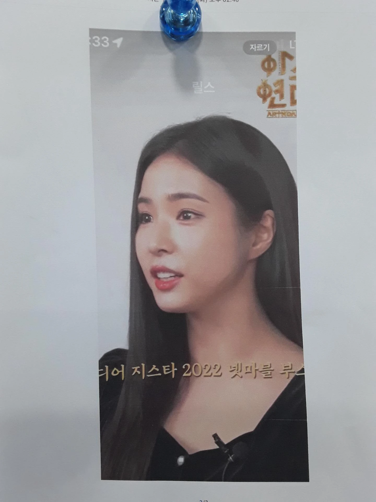 여러 차례 받은 코필러가 남긴 퍼진 코와 코막힘, 어떻게 정리하나 — 본문 사진 10