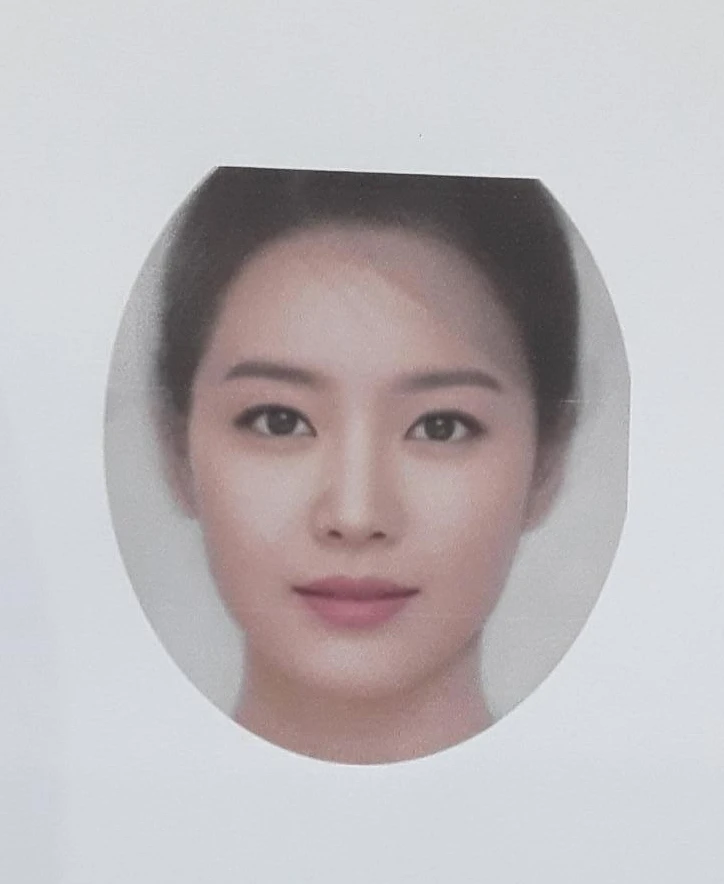 코 필러를 녹이지 않은 채 코가 퍼져 보이는 이유, 얄쌍한 라인을 만드는 방법 — 환자분 원하시던 이미지 사진
