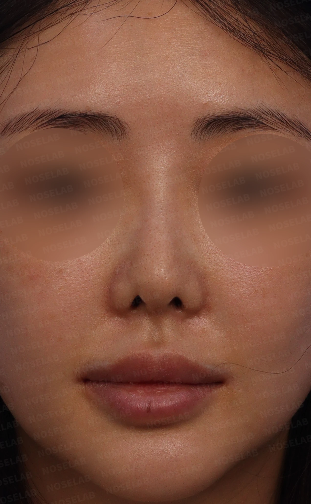 들린 코에서 비공 내리기를 계획하는 방법 — 본문 사진 1