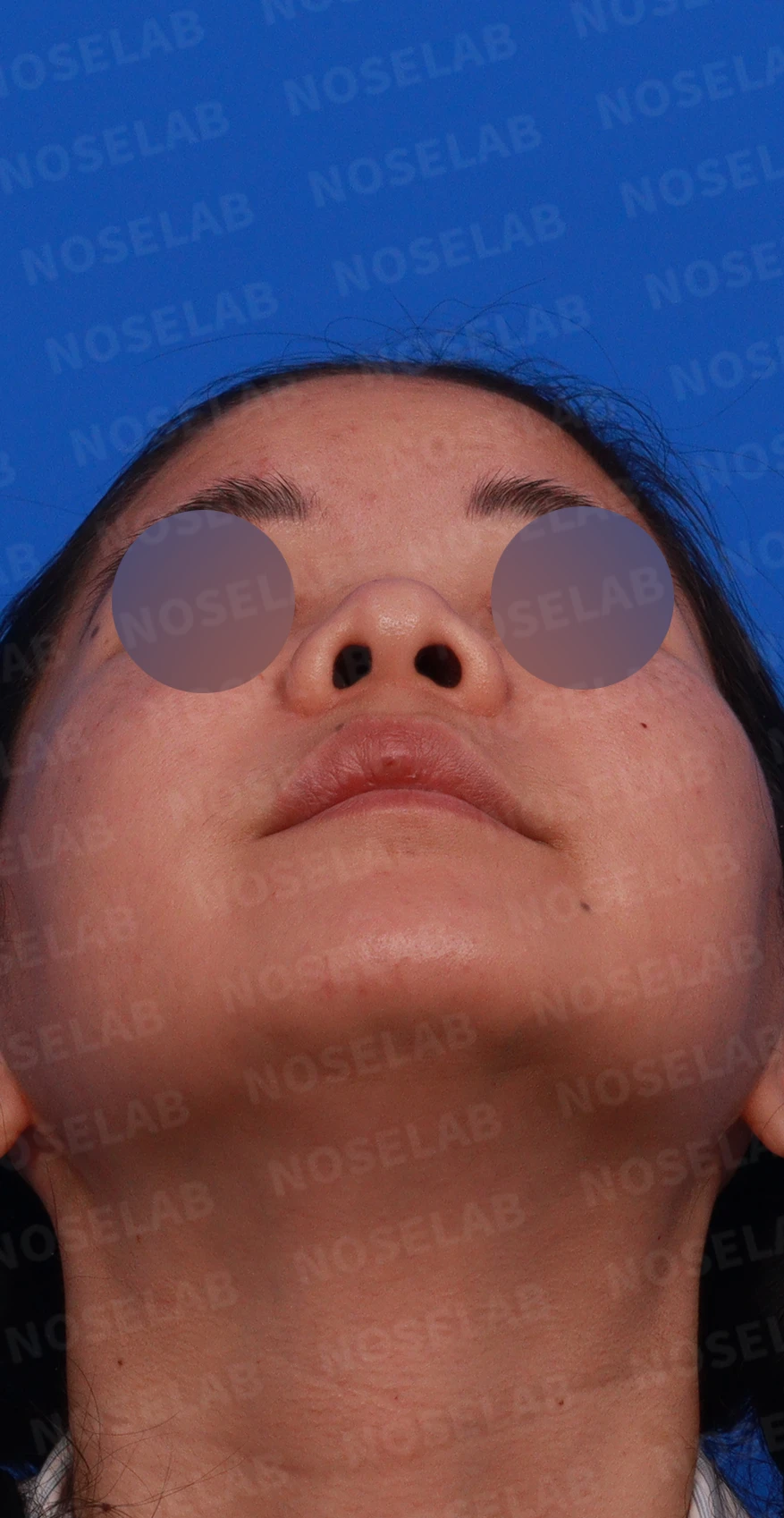 콧대가 평행선처럼 보이는 조건과 콧구멍 모양을 정하는 기준 — 디자인 상담 우측 측면 , 비스듬한 측면 , 비공 사진입니다.