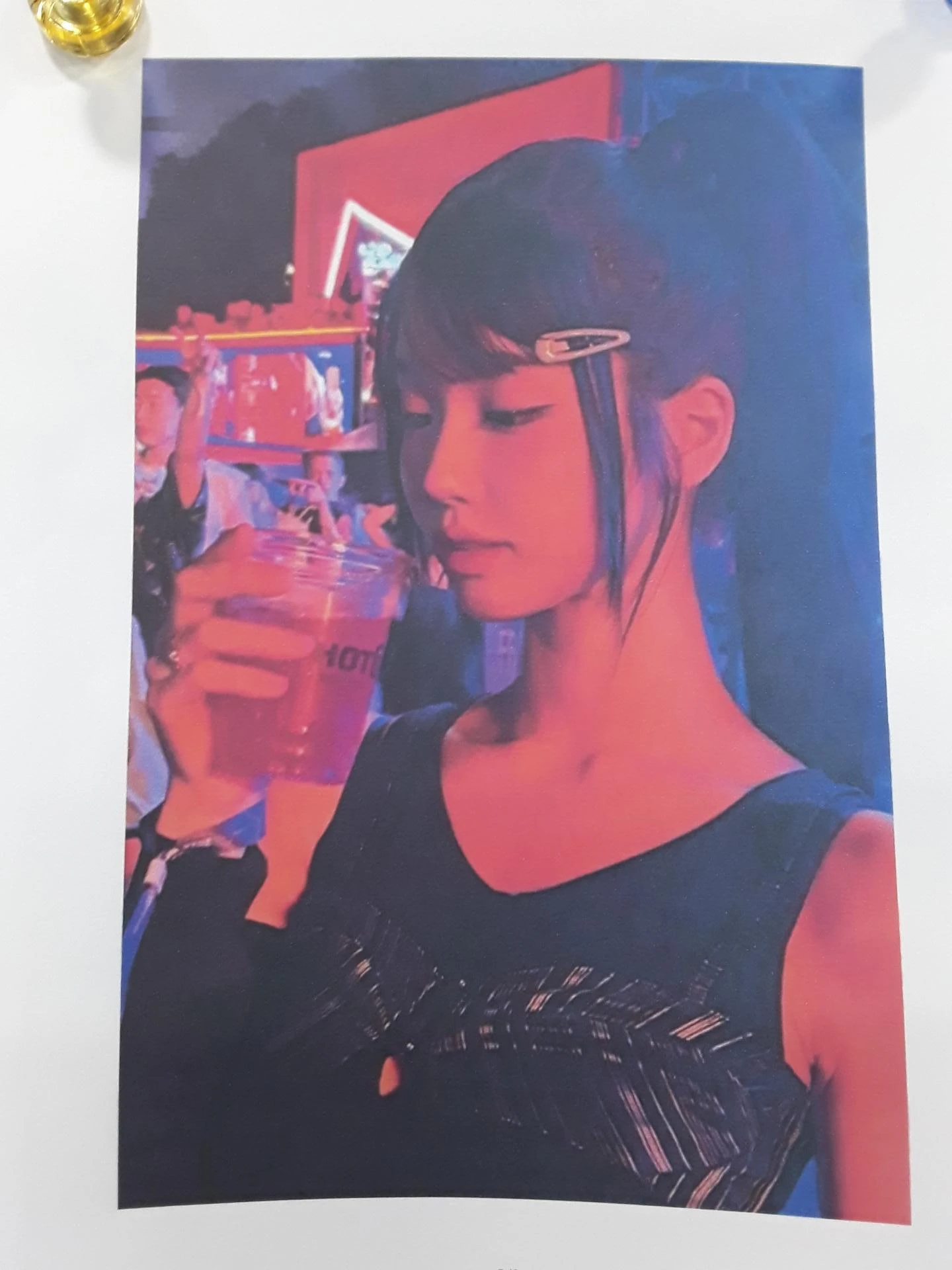 필러와 실 시술 뒤 코가 뭉툭해지는 이유, 이물질 제거와 코끝 교정 방법 — 본문 사진 8