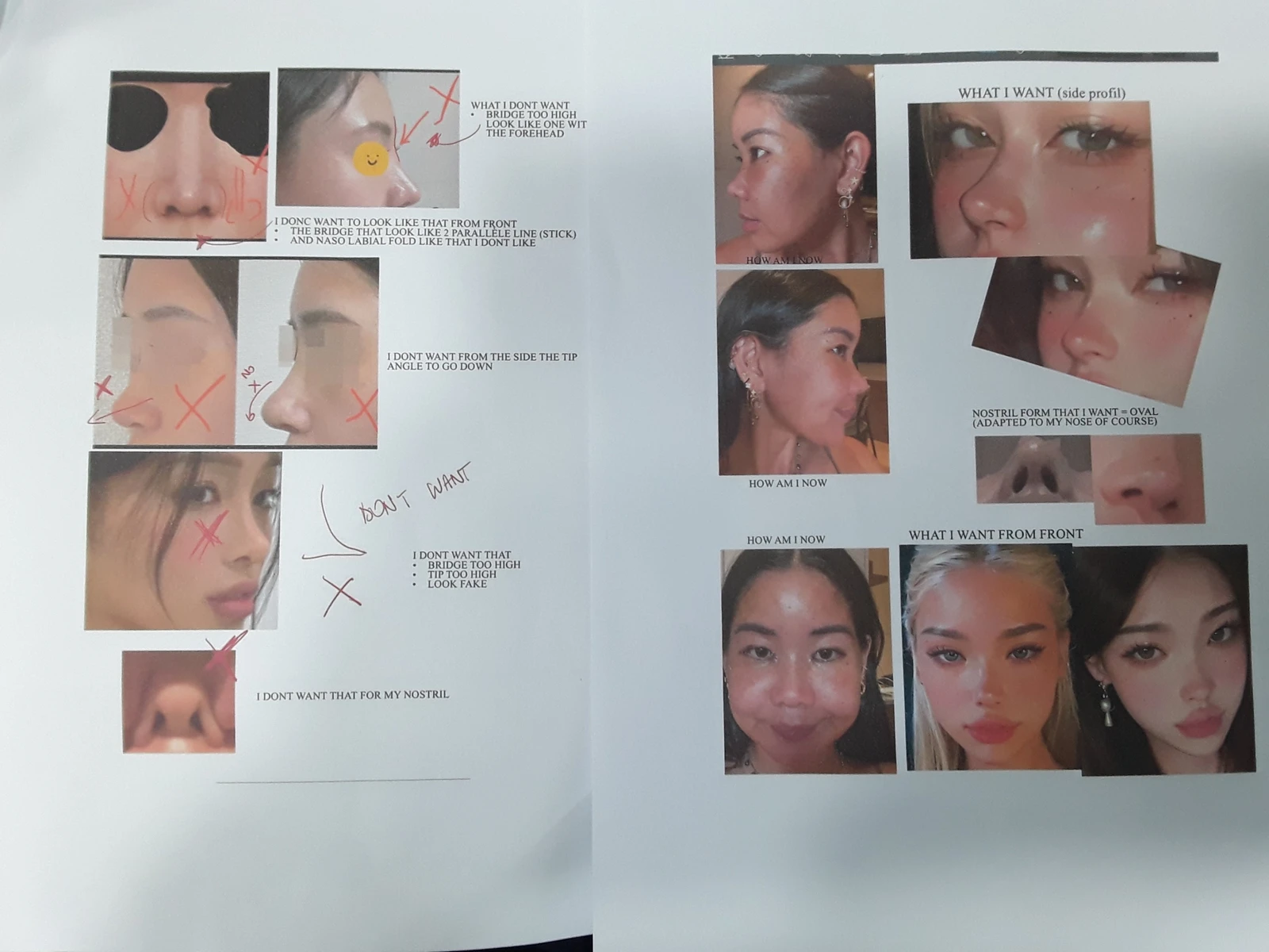 콧대가 평행선처럼 보이는 조건과 콧구멍 모양을 정하는 기준 — 환바분이 원하시는 개선 사항 및 이미지 사진