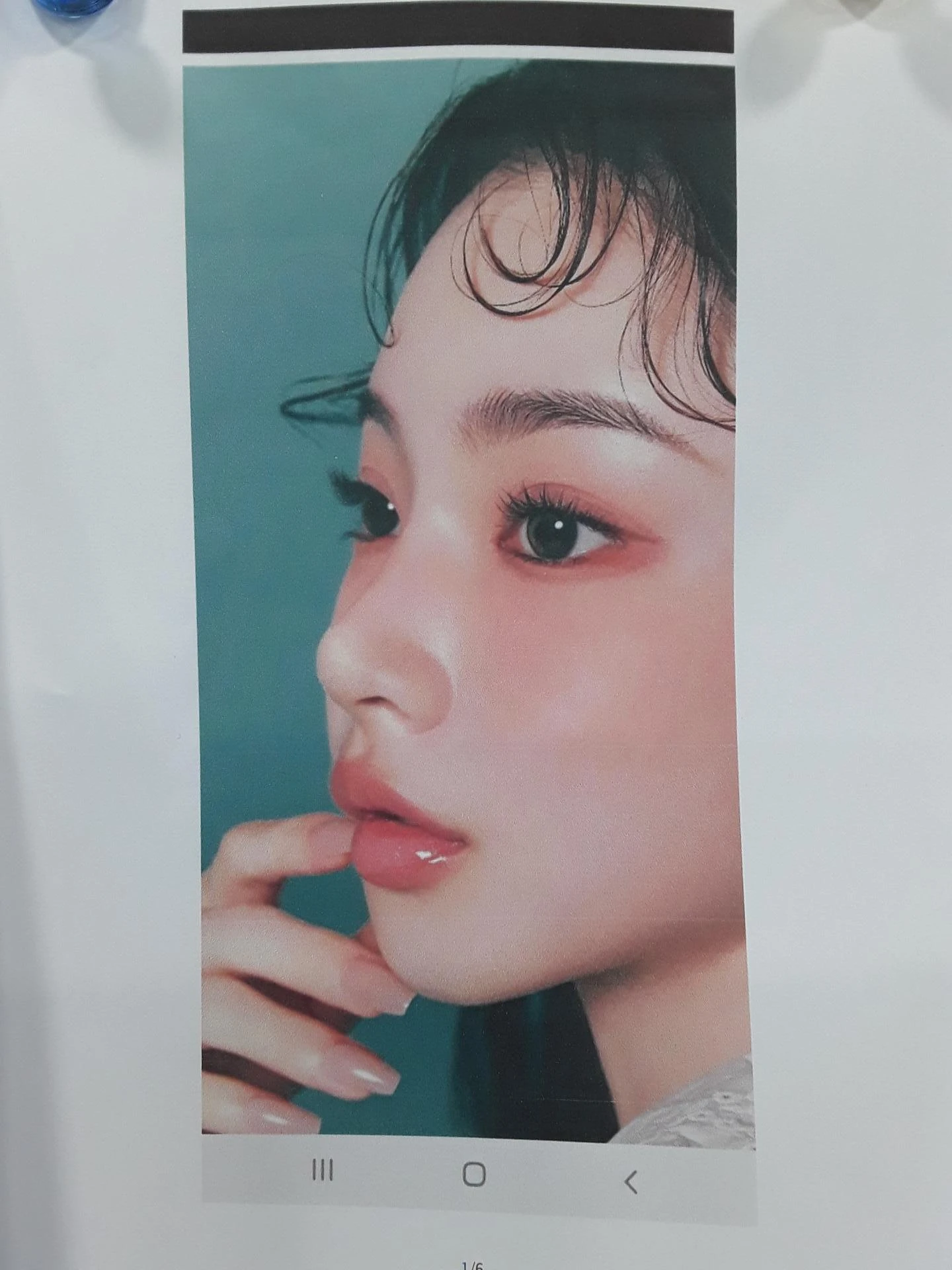 고양이 보형물 제거와 자연스러운 코 재건 - 휘어진 코성형 후기 — 본문 사진 7