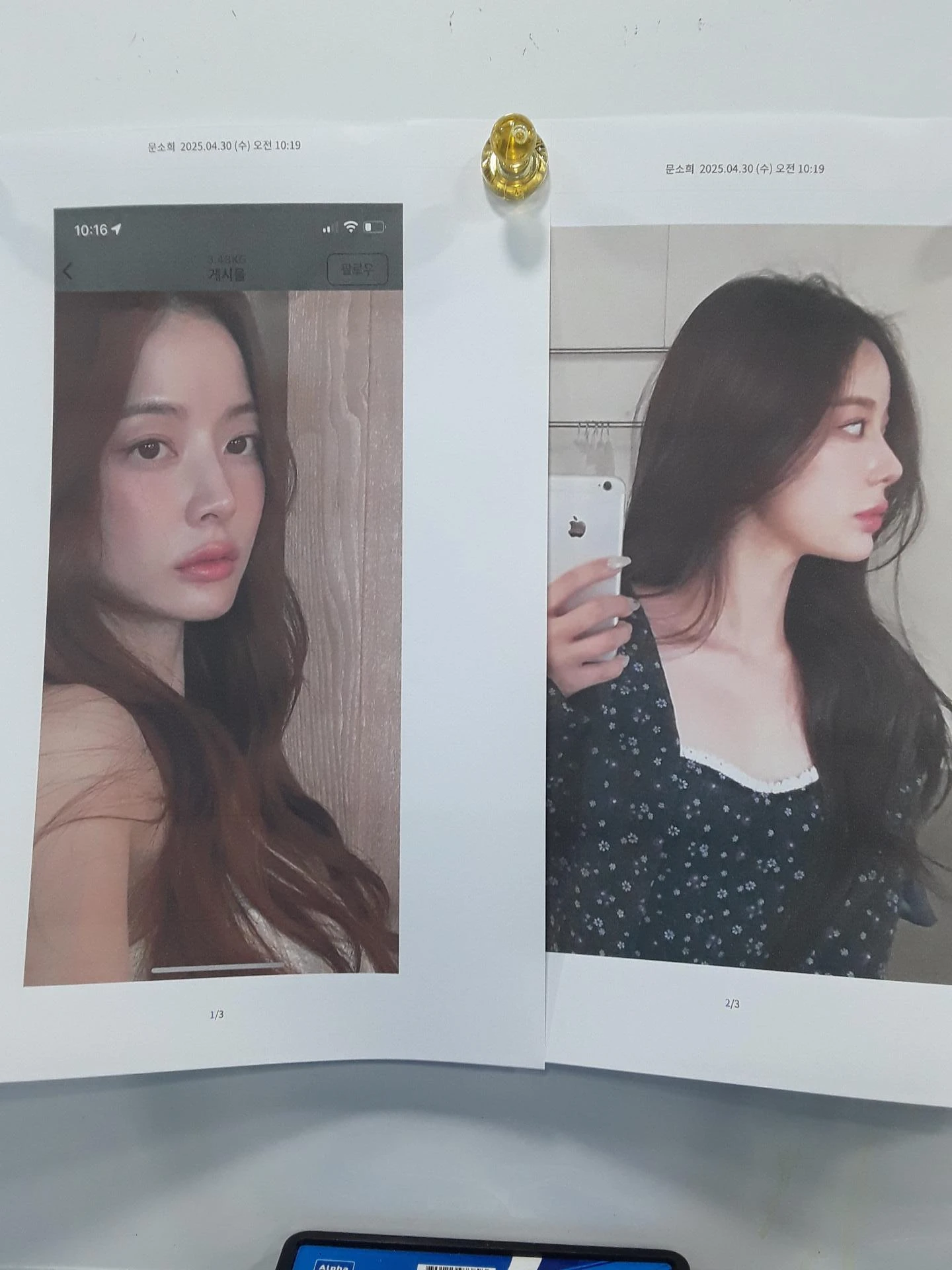 코끝이 비치는 이유와 코끝 포인트를 낮추는 교정 방법 — 환자분의 원하는 이미지