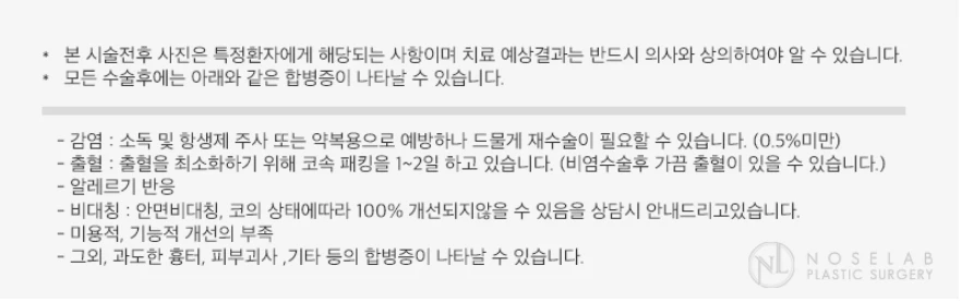 코가 과하게 높아져 부자연스러워 보이고 휘는 이유, 재건은 어떻게 하나 — 본문 사진 19