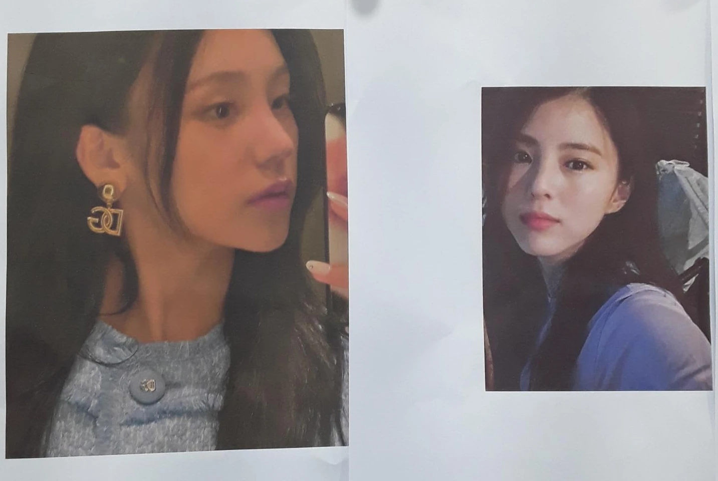 웃을 때만 화살코가 되는 이유와 코끝 연골 교정 방법 — 환자분 원하시는 이미지