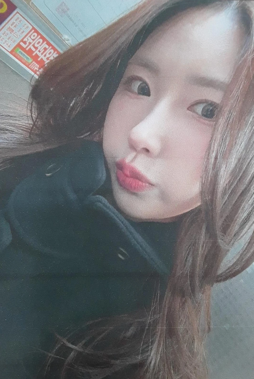복코와 짧은 코, 비주 함몰이 함께 나타나는 이유와 코끝 입체감을 만드는 방법 — 본문 사진 10