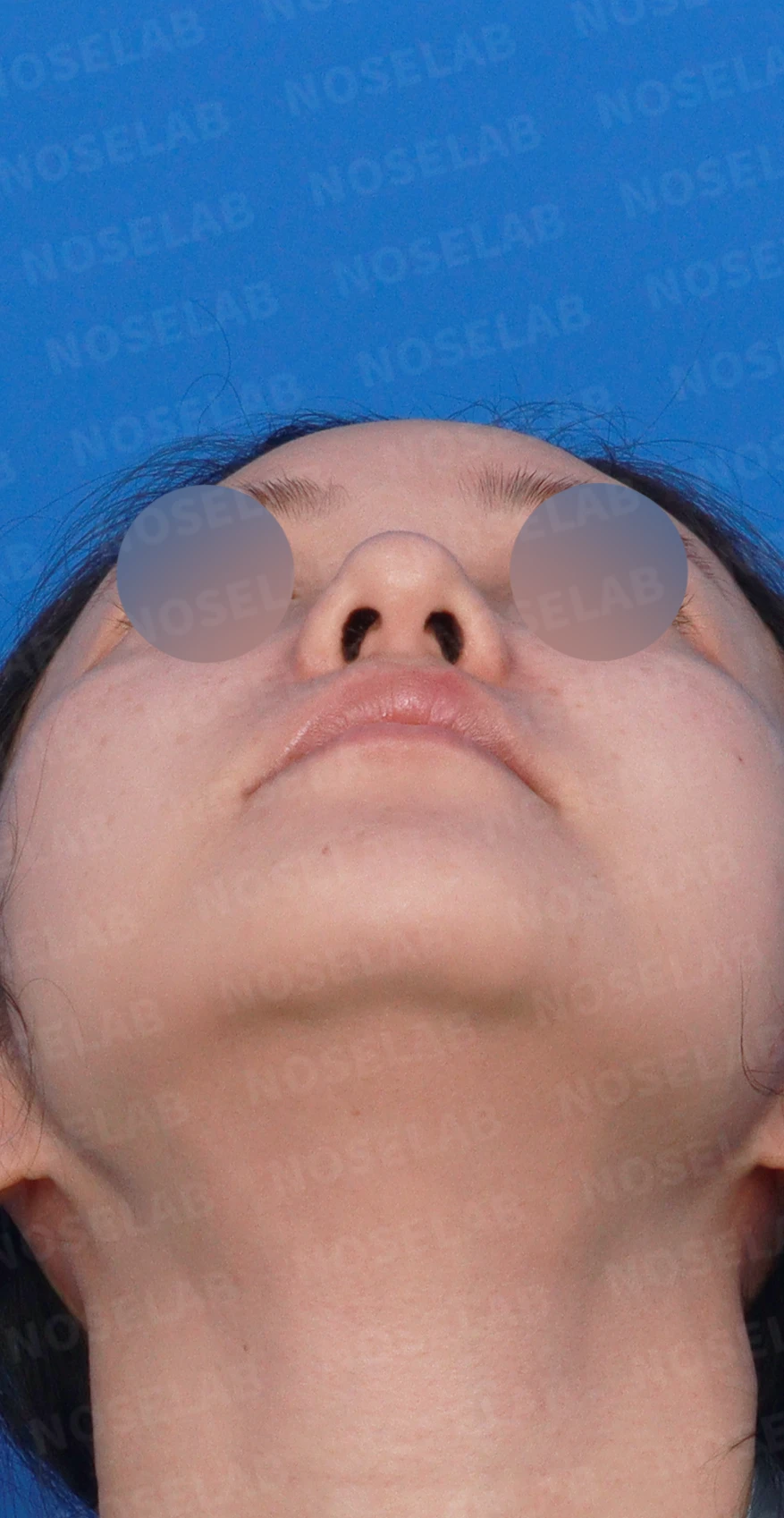 복코가 뭉툭하고 퍼져 보이는 이유와 코끝 입체감을 만드는 방법 — 디자인 상담 우측 측면, 비스듬한 측면, 비공 사진입니다