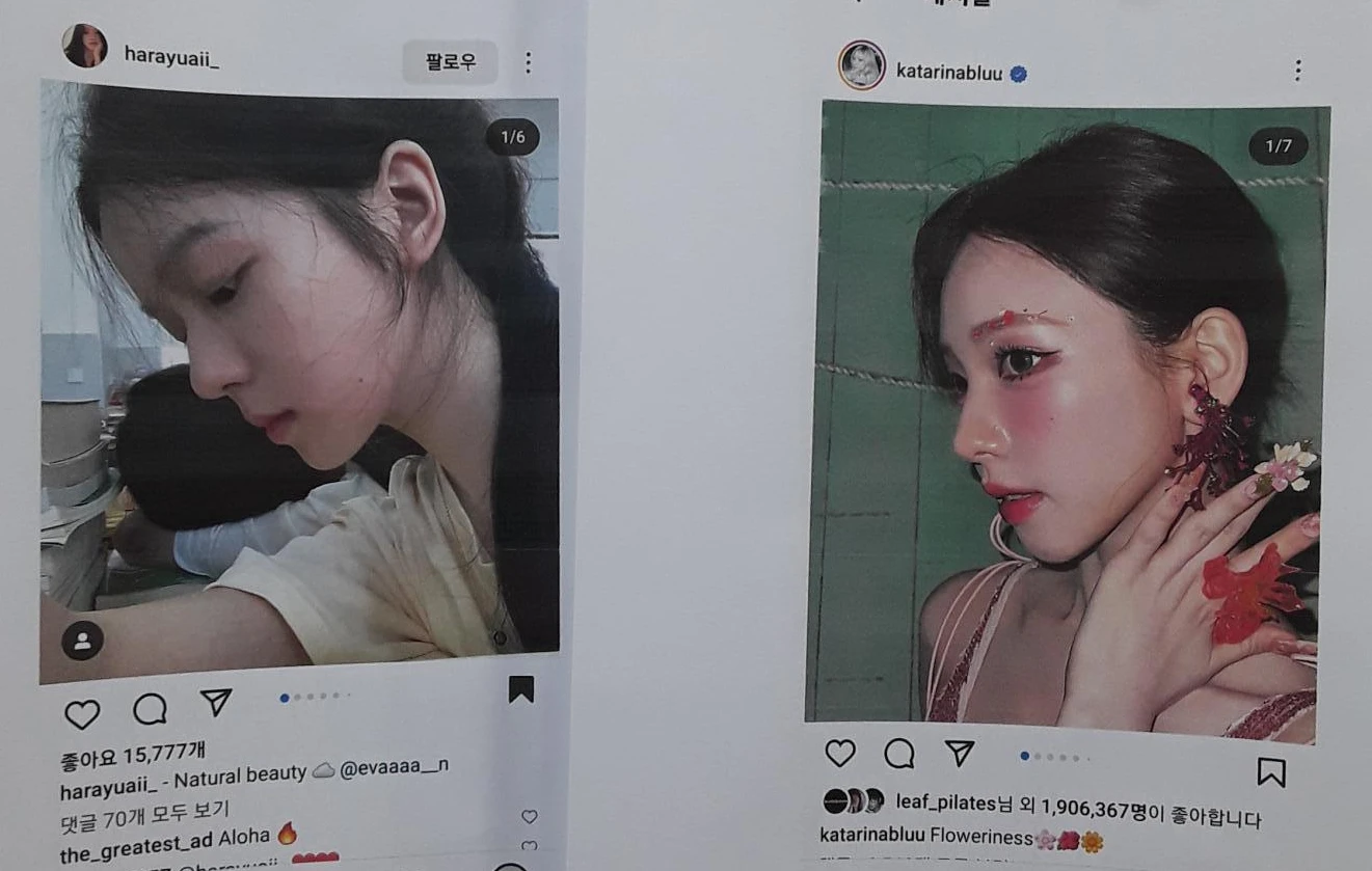 콧대가 뭉툭하게 퍼져 보이는 만성 이물 반응, 원인과 재건 방법 — 본문 사진 8