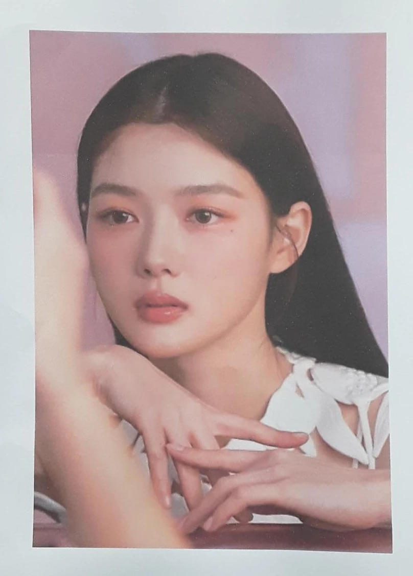 웃을 때만 화살코가 되는 이유와 코끝 연골 교정 방법 — 환자분 원하시는 이미지