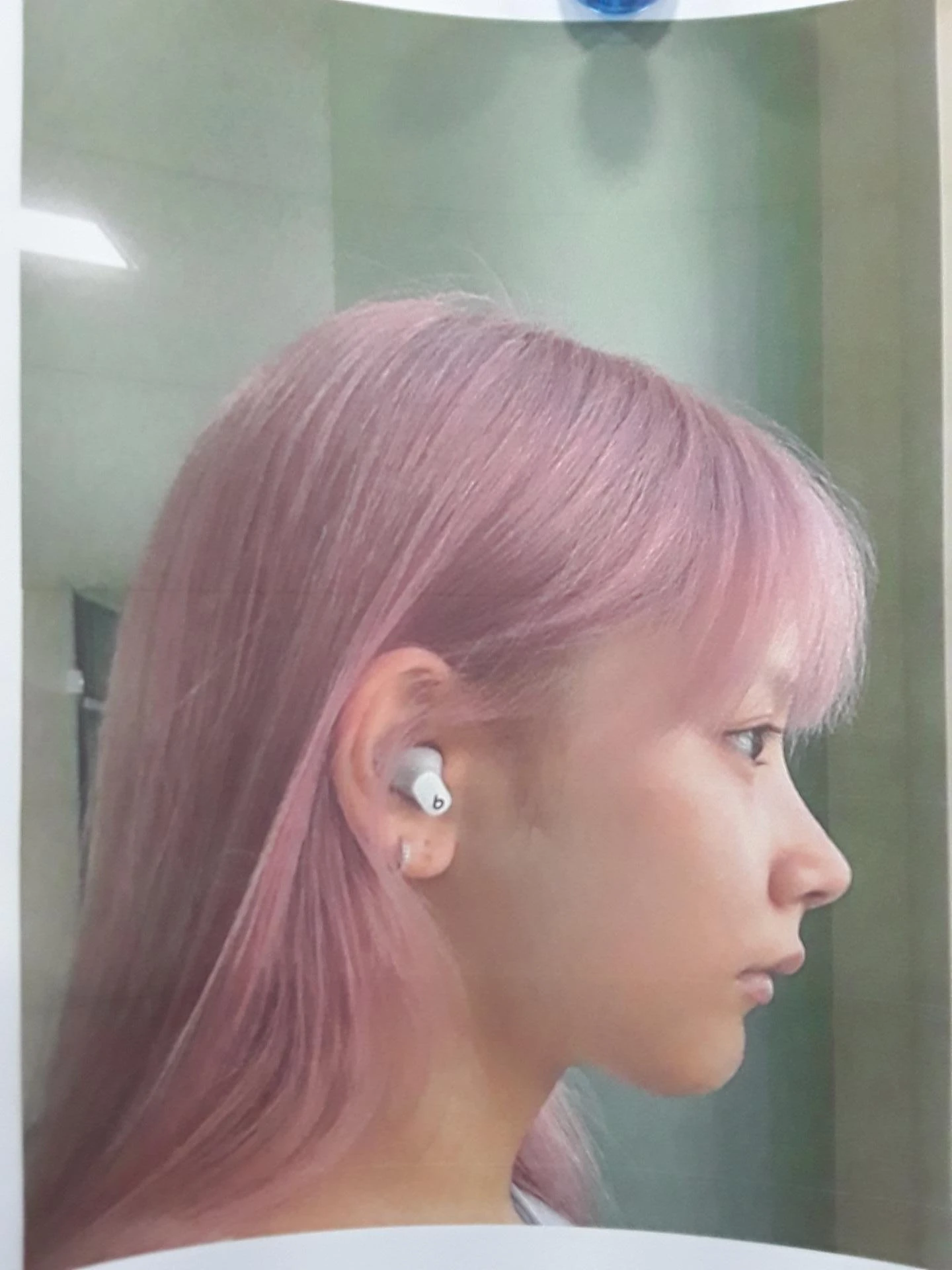 실리텍스 보형물이 비쳐 보이는 이유와 제거 후 재건은 어떻게 하나 — 환자분 원하시는 이미지 사진들