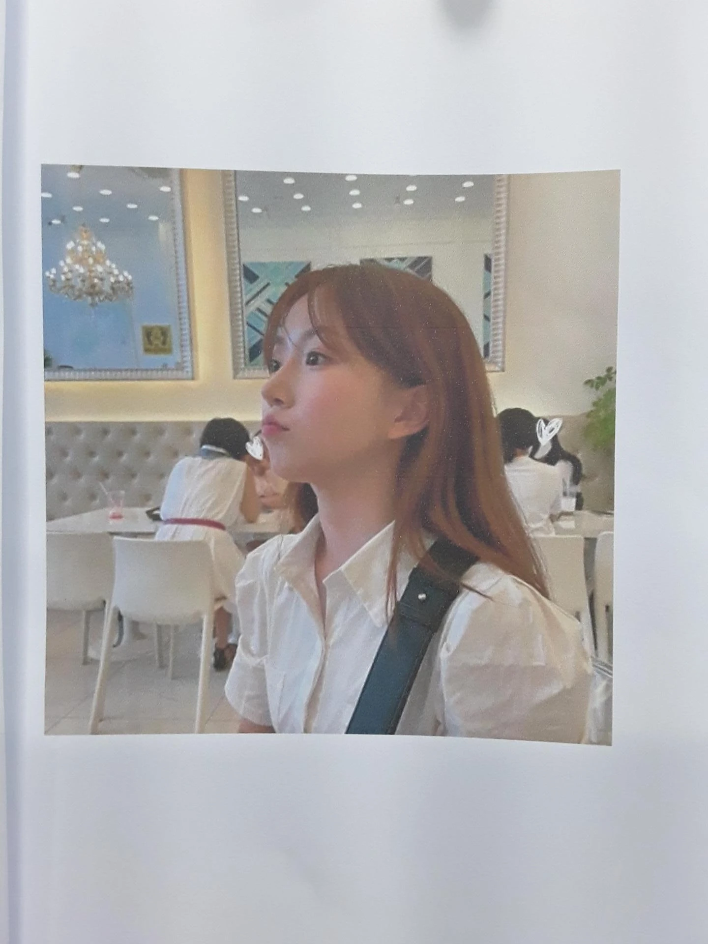 작고 뭉툭한 코는 어디까지 높일 수 있나 — 피부의 한계와 재건 방법 — 환자분 원하시는 이미지