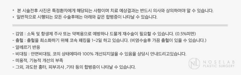 긴 코와 매부리코의 자가늑연골 재수술 및 비주 교정 방법 — 본문 사진 5