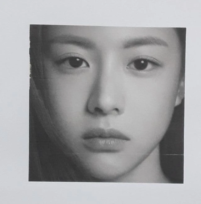 코 필러를 녹이지 않은 채 코가 퍼져 보이는 이유, 얄쌍한 라인을 만드는 방법 — 환자분 원하시던 이미지 사진