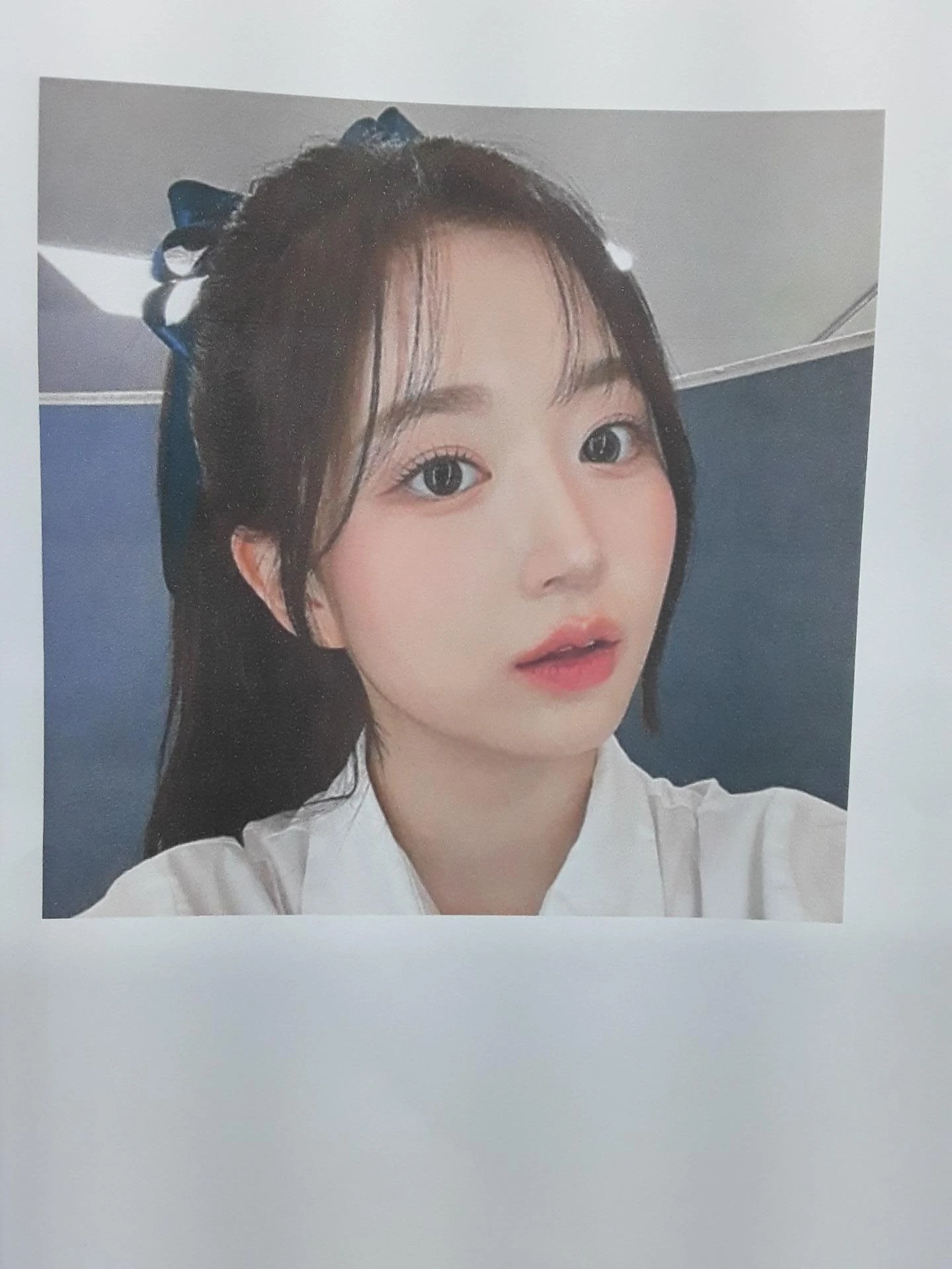 작고 뭉툭한 코는 어디까지 높일 수 있나 — 피부의 한계와 재건 방법 — 환자분 원하시는 이미지