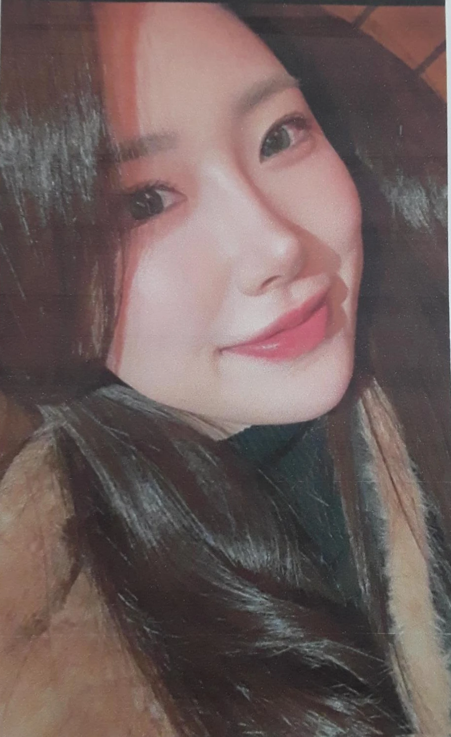 복코와 짧은 코, 비주 함몰이 함께 나타나는 이유와 코끝 입체감을 만드는 방법 — 본문 사진 8
