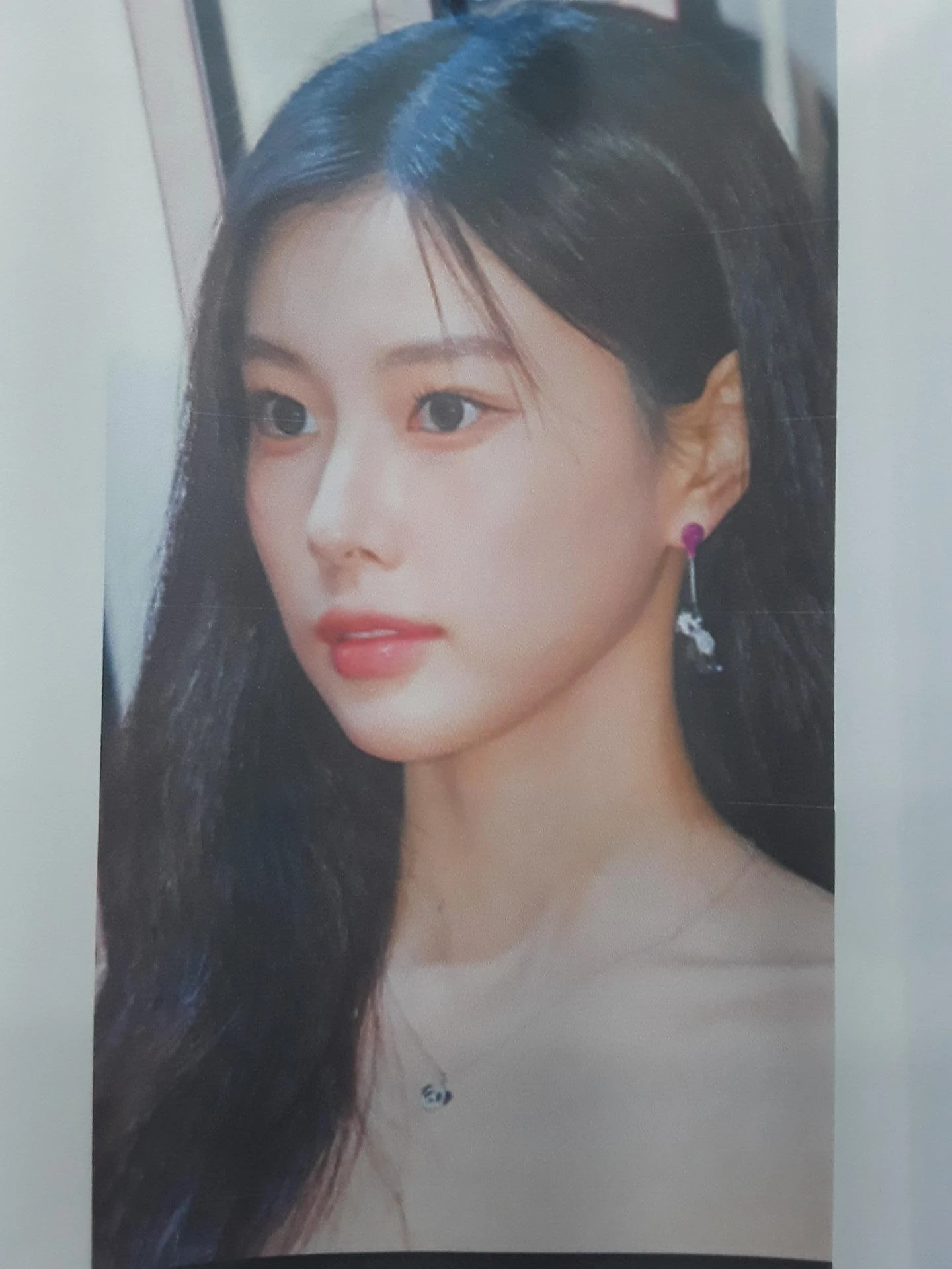 휘어진 코 교정과 비염 개선 - 자가늑연골 재건술 후기 — 환자분 원하는 이미지 사진들입니다.
