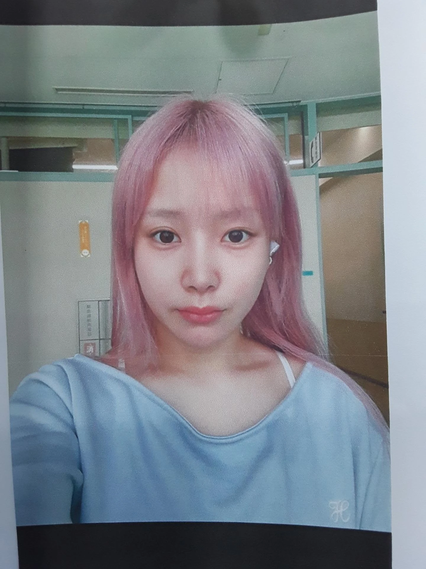 실리텍스 보형물이 비쳐 보이는 이유와 제거 후 재건은 어떻게 하나 — 환자분 원하시는 이미지 사진들
