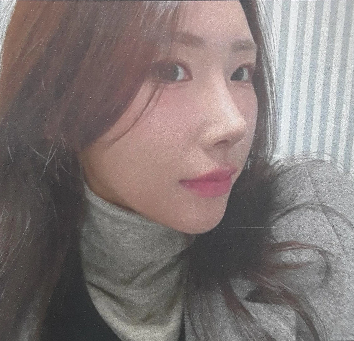 복코와 짧은 코, 비주 함몰이 함께 나타나는 이유와 코끝 입체감을 만드는 방법 — 본문 사진 9