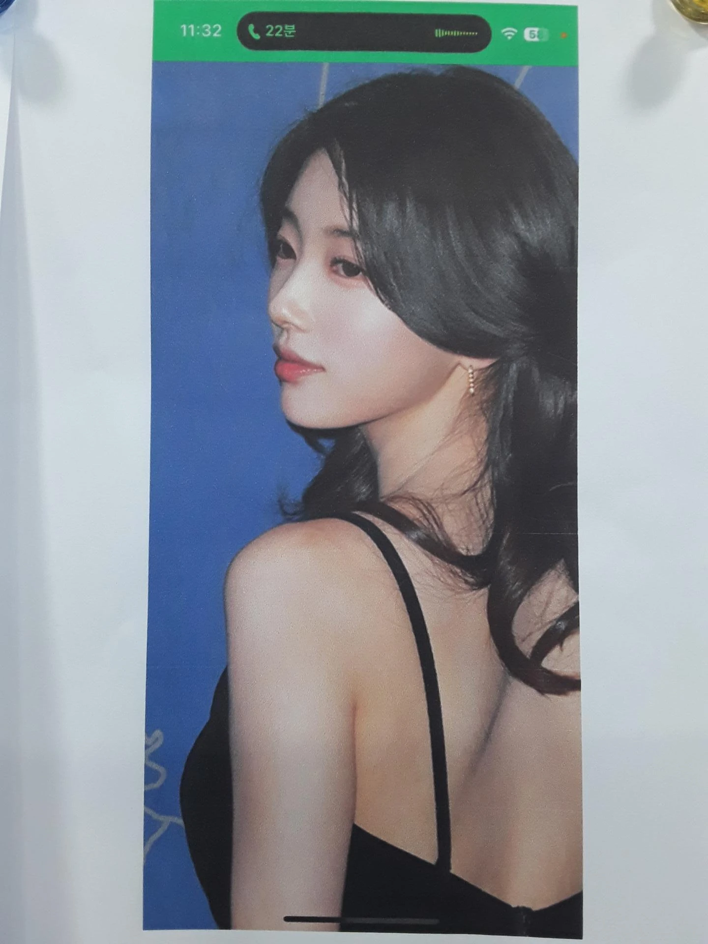 필러와 실 시술 뒤 코가 뭉툭해지는 이유, 이물질 제거와 코끝 교정 방법 — 본문 사진 9