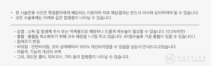 심한 염증후 코끝 피부 부분괴사후 구축된 코 재건 수술 방법 — 본문 사진 19