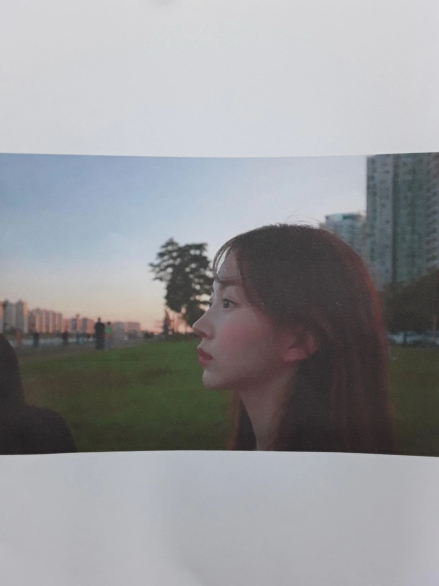 작고 뭉툭한 코는 어디까지 높일 수 있나 — 피부의 한계와 재건 방법 — 환자분 원하시는 이미지