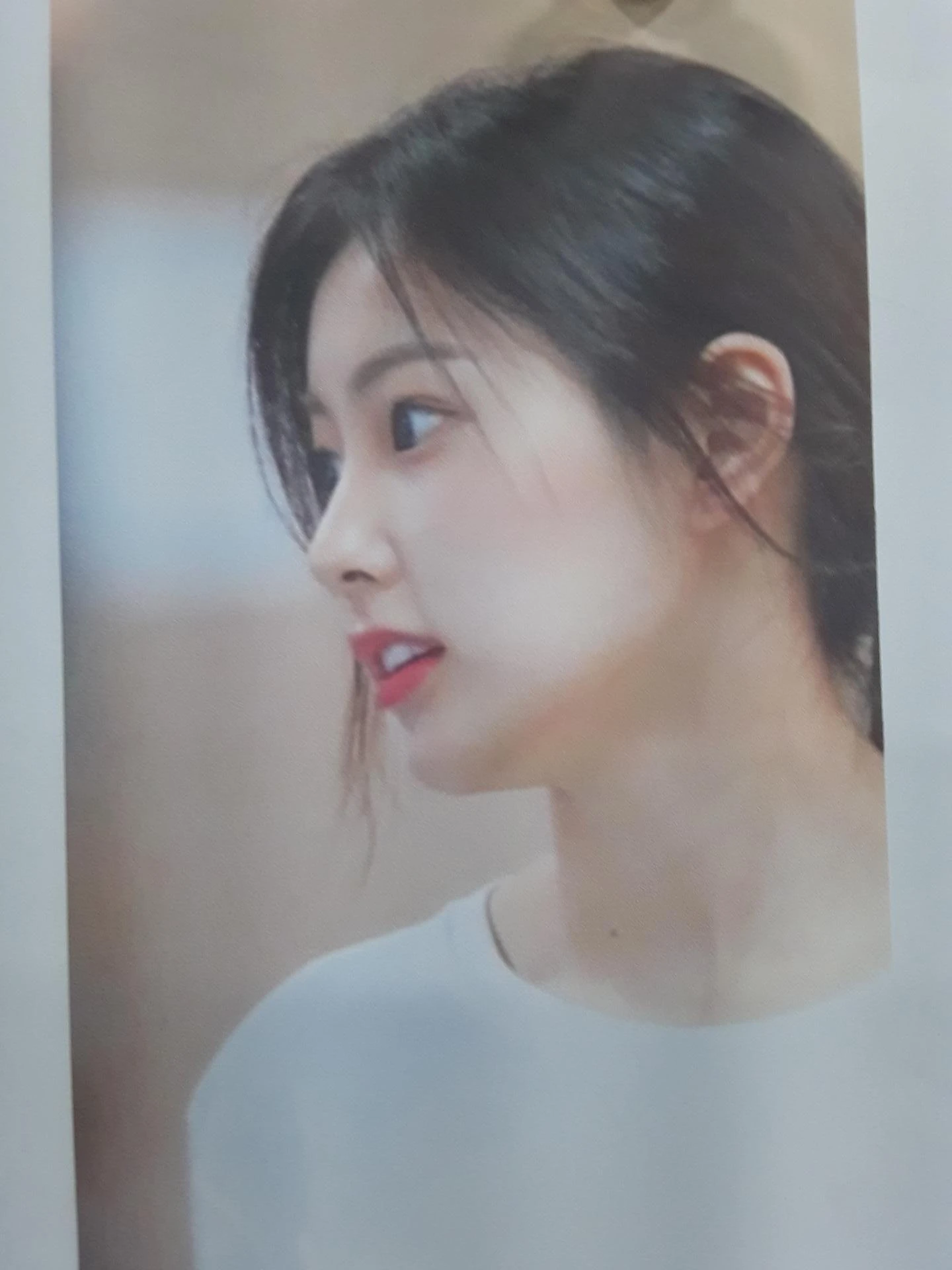 휘어진 코 교정과 비염 개선 - 자가늑연골 재건술 후기 — 환자분 원하는 이미지 사진들입니다.